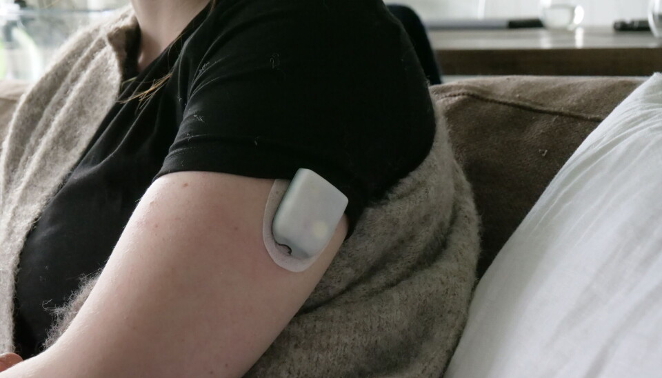 PUMPE: Madelen har festet insulinpumpen på overarmen. Denne pumper inn insulin gjennom hele dagen.